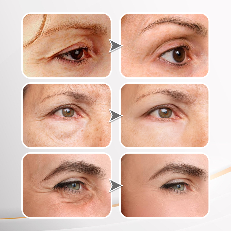 Instant Wrinkle Eye Tightener cream