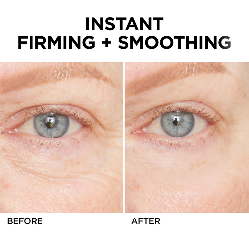 Instant Wrinkle Eye Tightener cream